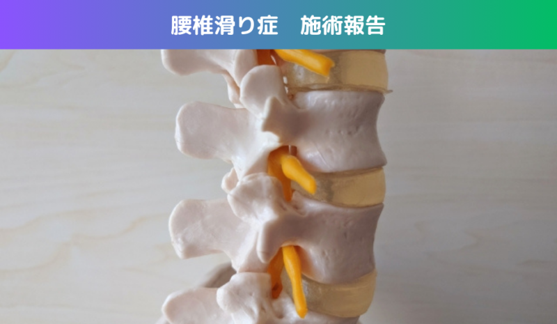 腰椎滑り症　施術報告